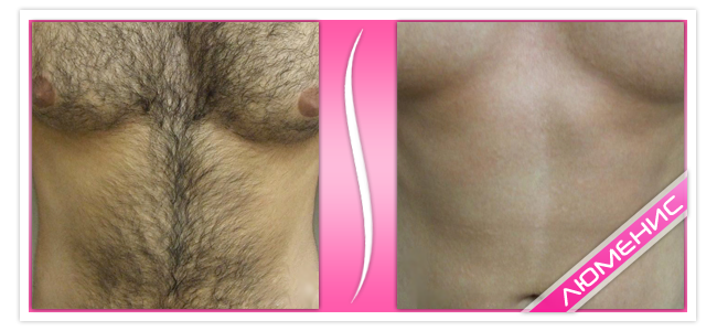lum_givot